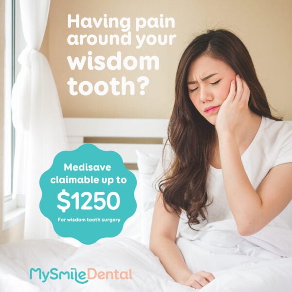 Wisdom Teeth Pain MySmile Dental Clinic