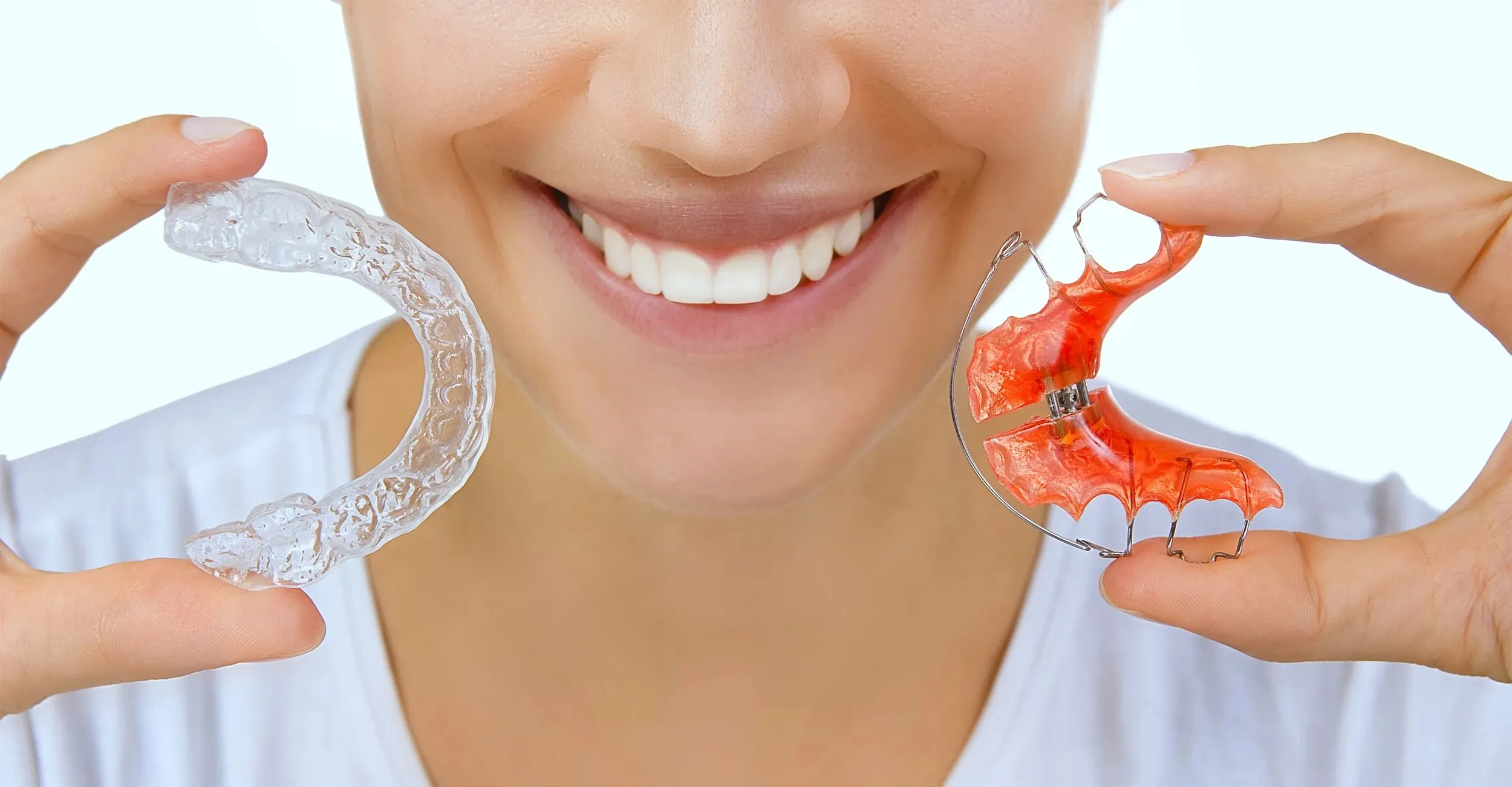 Retainers After Invisalign Aligners: What To Expect