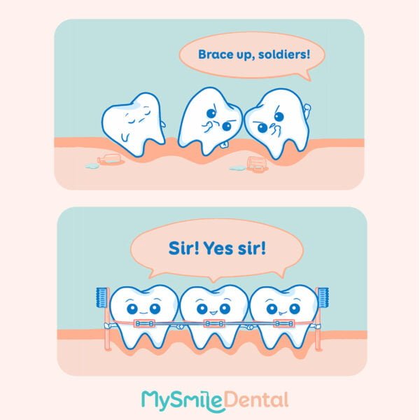 mysmile dental braces