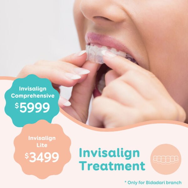 invisalign mysmile dental