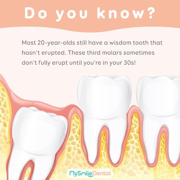 wisdom teeth fun fact