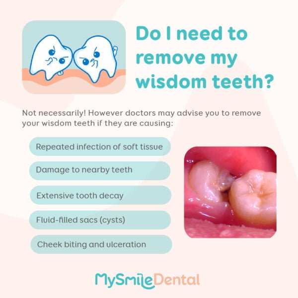 should i remove wisdom teeth mysmile dental