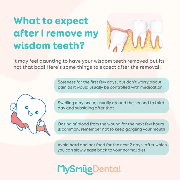 What to expect after I remove my wisdom teeth?