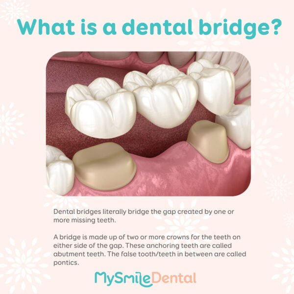 MySmile Dental - A Breath of Confidence