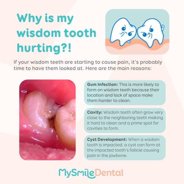 Wisdom teeth pain? MySmile Dental Clinic