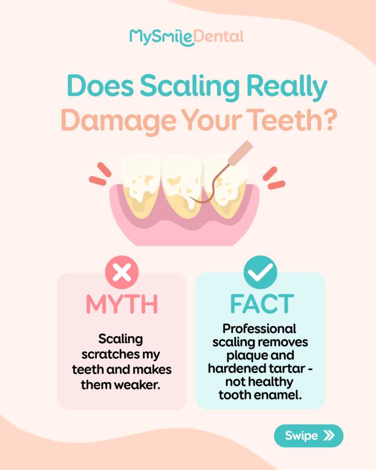 Does Scaling Really Damage Your Teeth? The Truth About Dental Cleaning